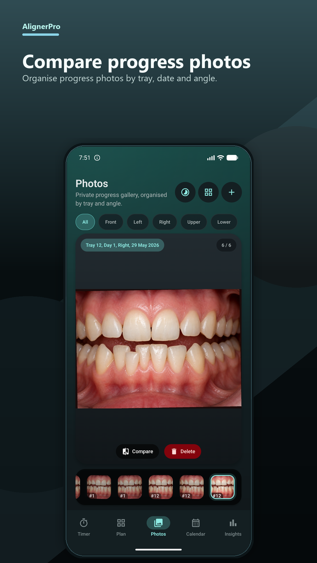 AlignerPro teeth progress photo tracker showing a demo dental photo organised by tray, day and angle